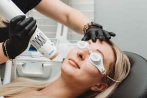prevent pigmentation, dark spot prevention, Indian skincare routine, how to stop melasma, skin brightening habits